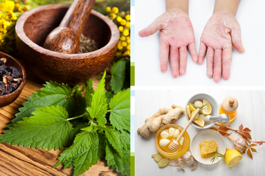 Top 10 Effective Homemade Remedies for Fungal Infections Blog Image