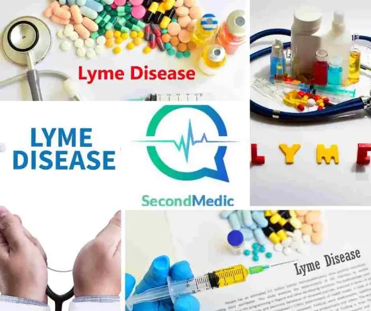 Lyme medical second opinion
