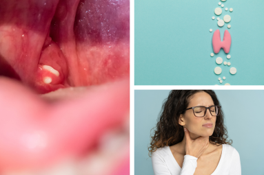Removing Tonsil Stones at Home: DIY Techniques and Safety Precautions Blog Image