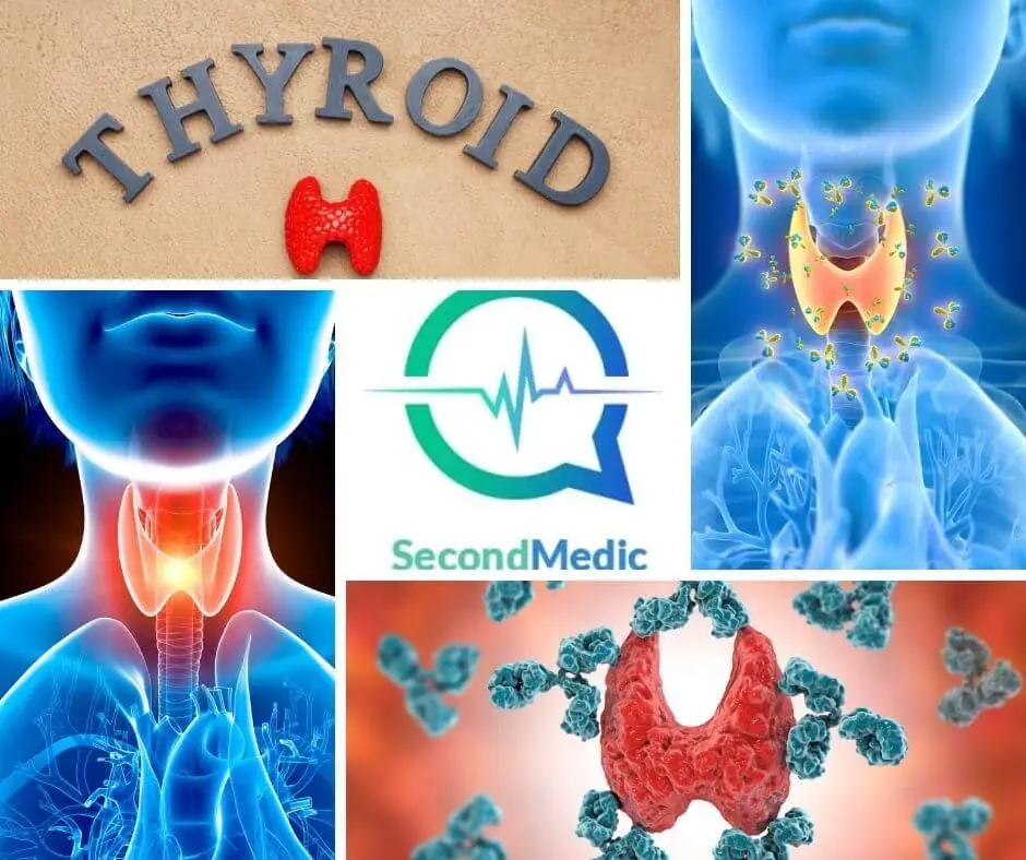 Thyroid Disease: Causes, Symptoms, Risk Factors, Testing