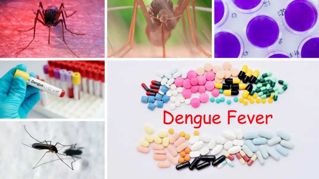 What are the Symptoms, causes & treatment of Dengue fever?