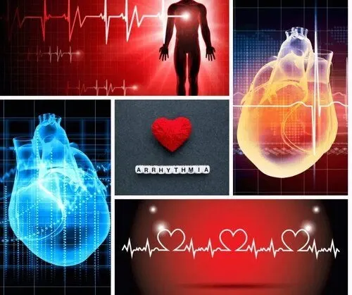 What causes irregular heartbeats?