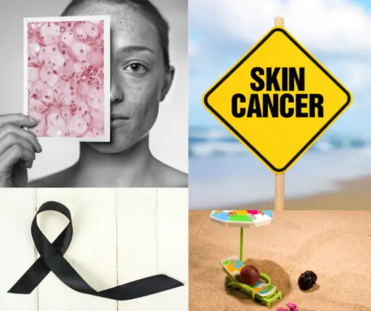 Is skin cancer really serious?