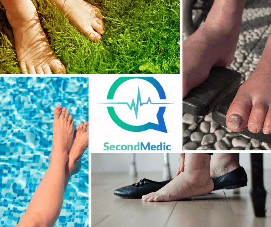 Specialist Doctors provide Expert medical Opinion on what swollen feet tell you about your heart.