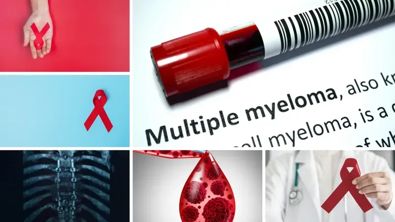 Multiple myeloma cause, prevention, symptoms, diagnosis & treatment.