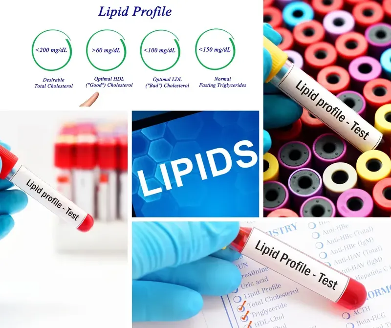 What is the lipid profile test used for?
