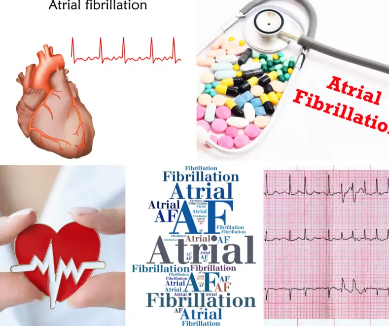 What is the main cause & cure of atrial fibrillation?