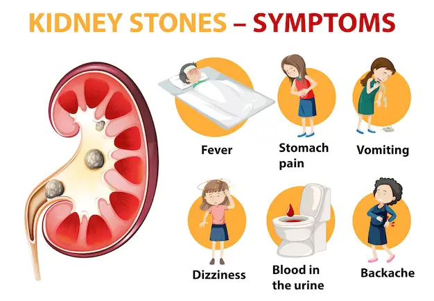 What are the symptoms of Kidney Stones?