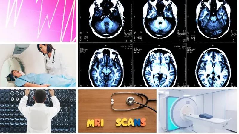 Understanding MRI Scan, benefits, diagnosis, sideeffects