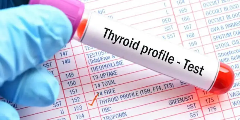 Thyroid Testing and Weight Management