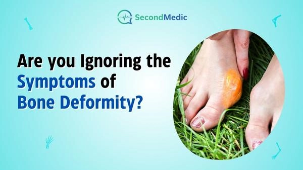 Symptoms of Bone Deformity
