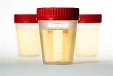 COMPLETE URINE ANALYSIS