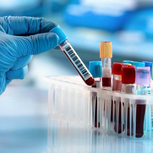 Free thyroxine (FT4)
