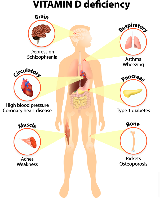 25-OH Vitamin D (Total)