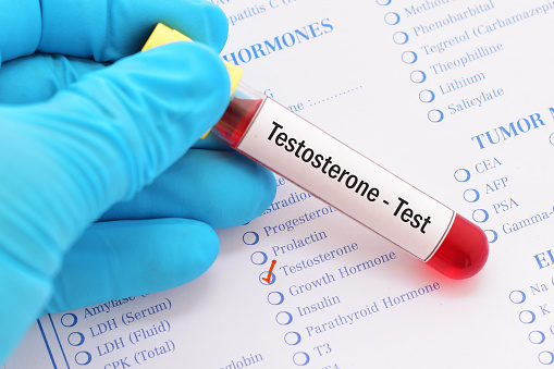 TESTOSTERONE