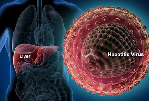 ANTI HEPATITS A VIRUS (ANTI HAV) - IGM
