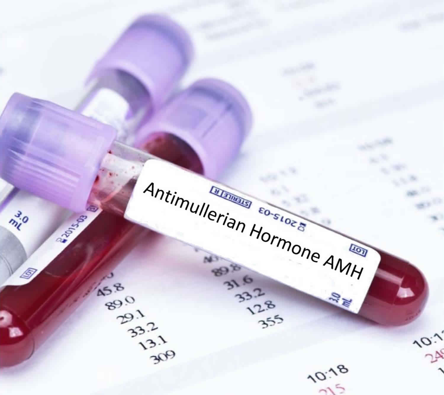 Anti Mullerian Hormone