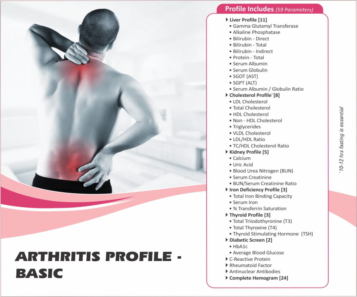 ARTHRITIS PROFILE - BASIC