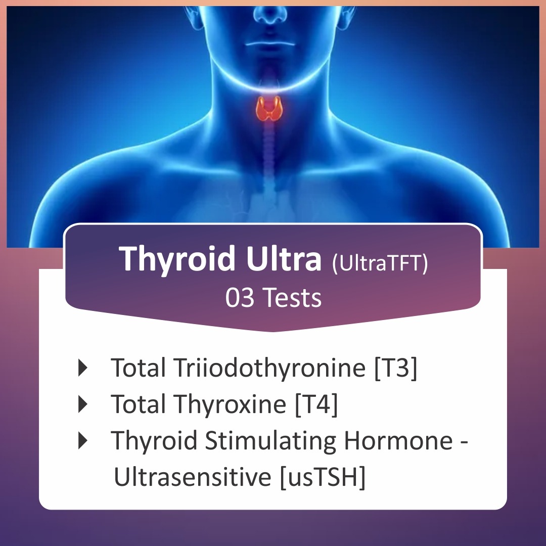 T3-T4-USTSH